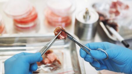 Gloved hands in a laboratory holding a small piece of raw meat with forceps above a sterile tray, with petri dishes and lab equipment blurred in the background