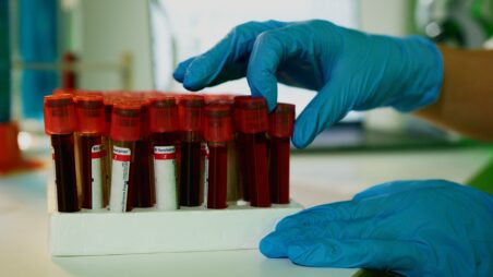 Gloved hand selecting a blood sample tube from a rack of vials