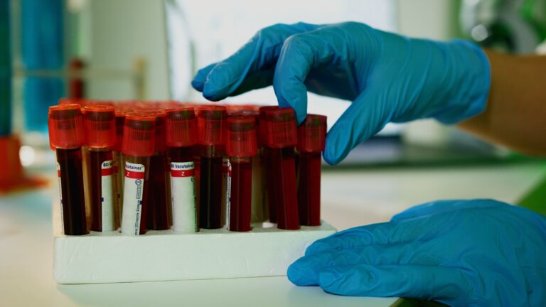 Gloved hand selecting a blood sample tube from a rack of vials