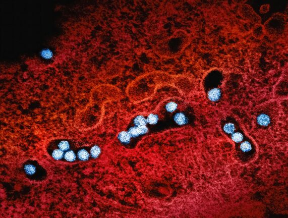 West Nile Virus